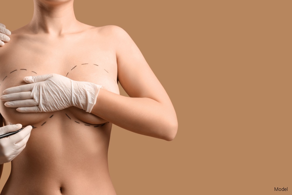 Plastic surgeon marking woman's breast on brown background