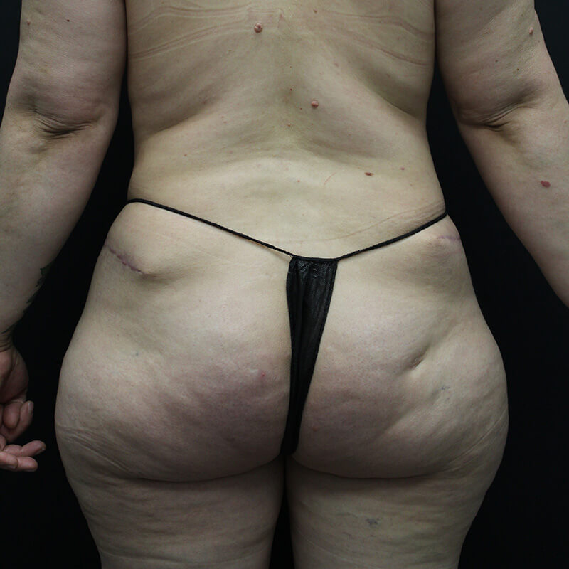 Case--1983 | Before BBL 1