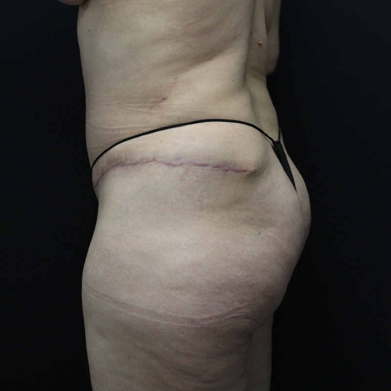 Case--1983 | Before BBL 5