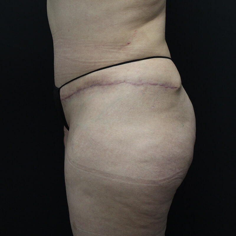 Case--1983 | Before BBL 4