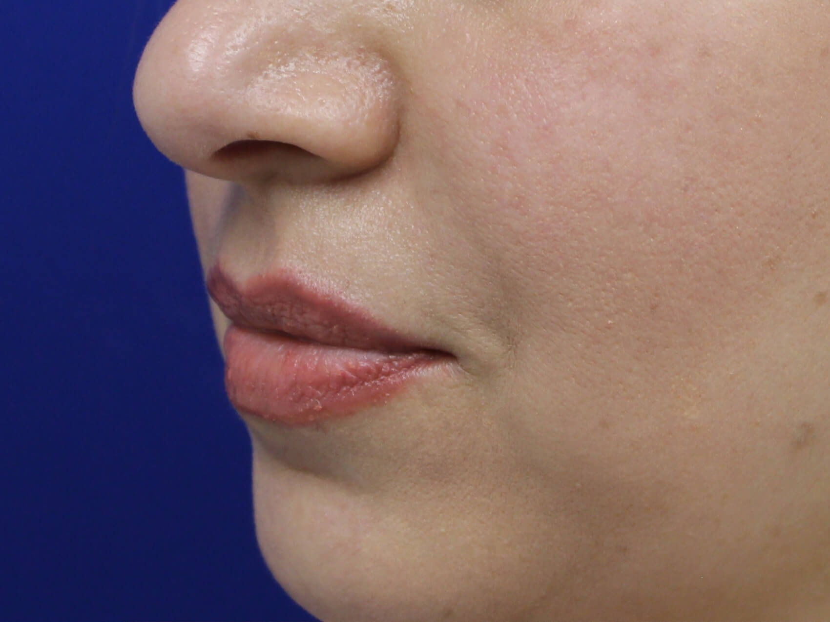 Case--4149 | Before Face 5