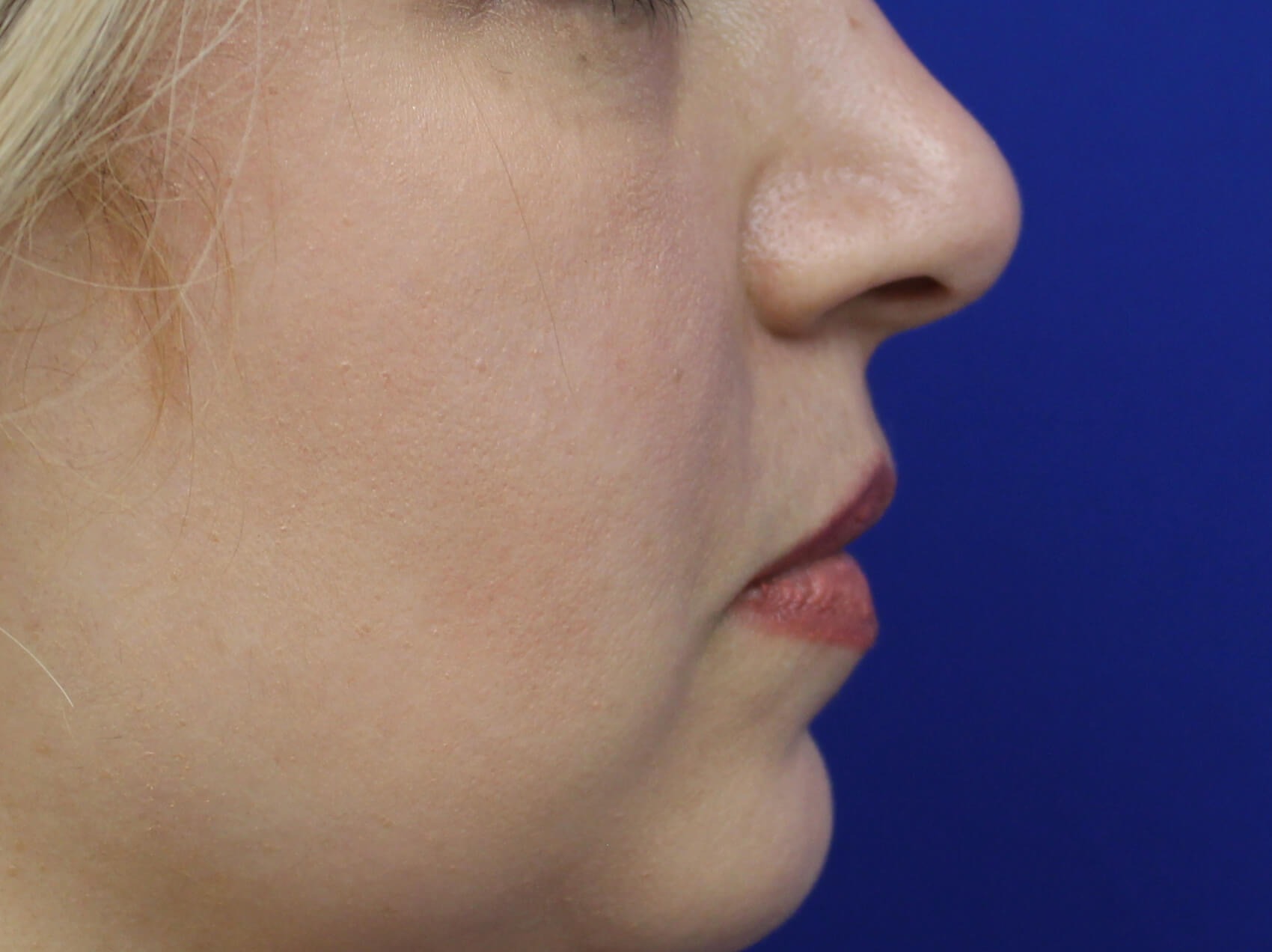 Case--4149 | Before Face 3