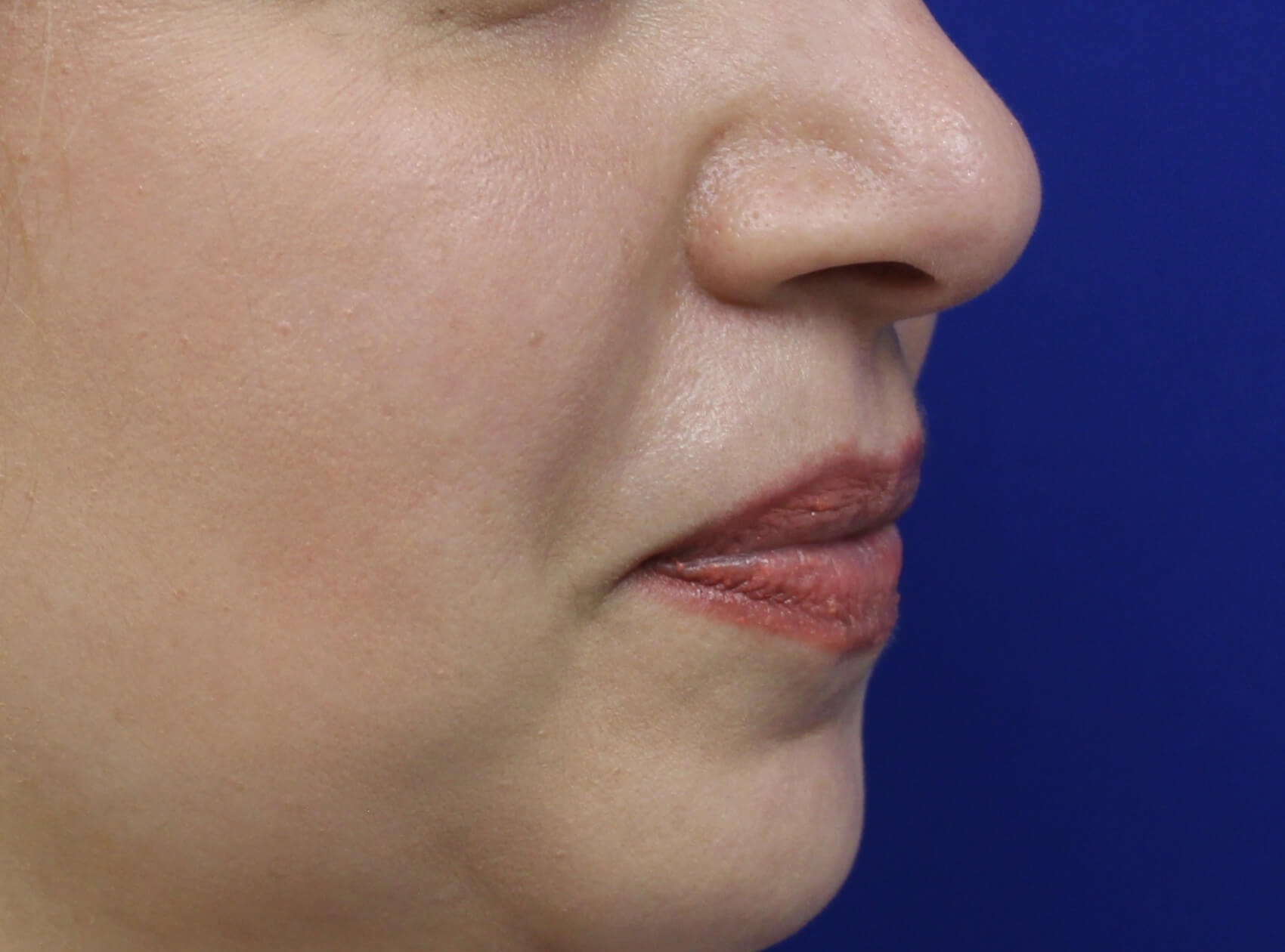 Case--4149 | Before Face 2