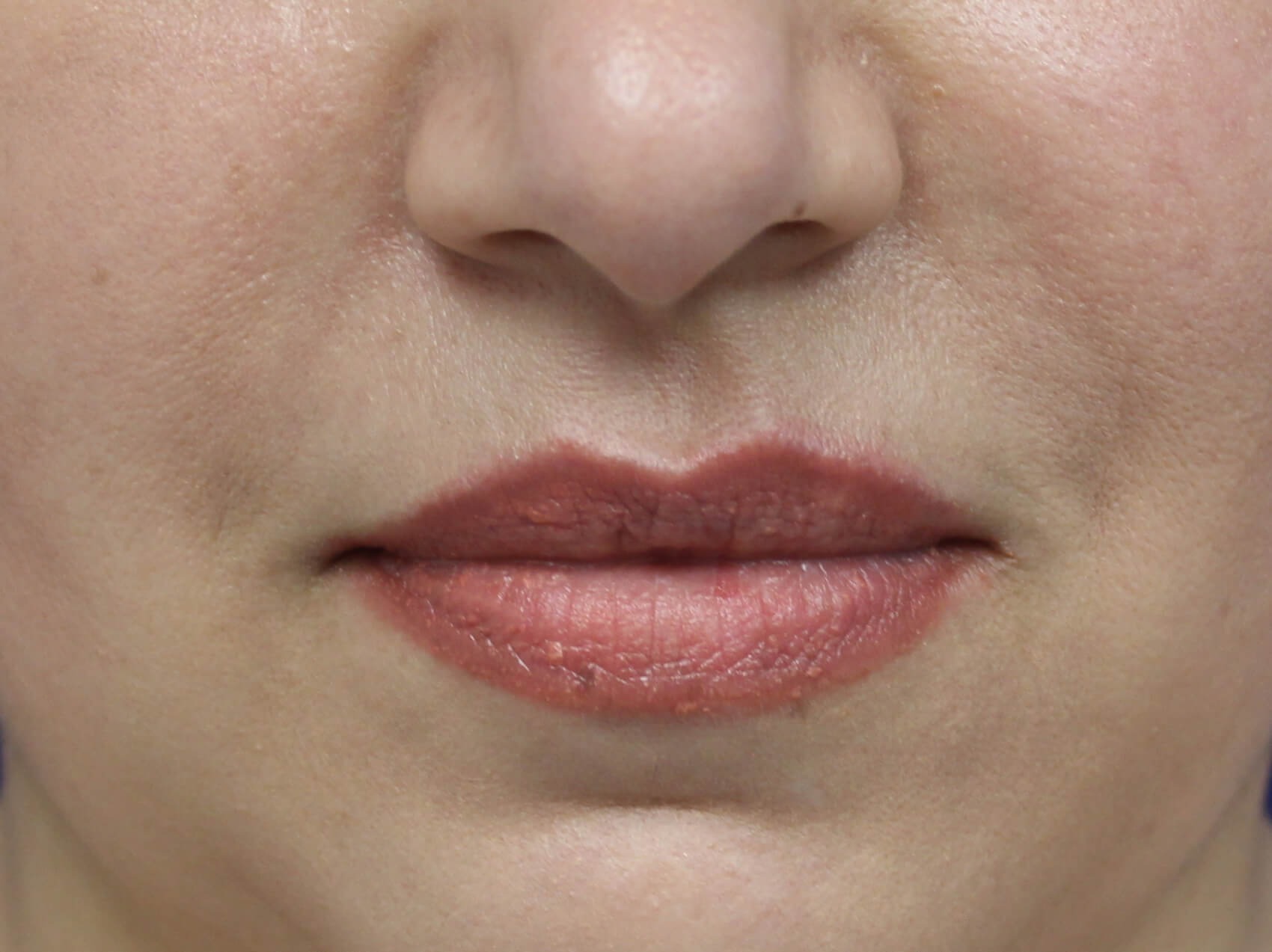 Case--4149 | Before Face 1