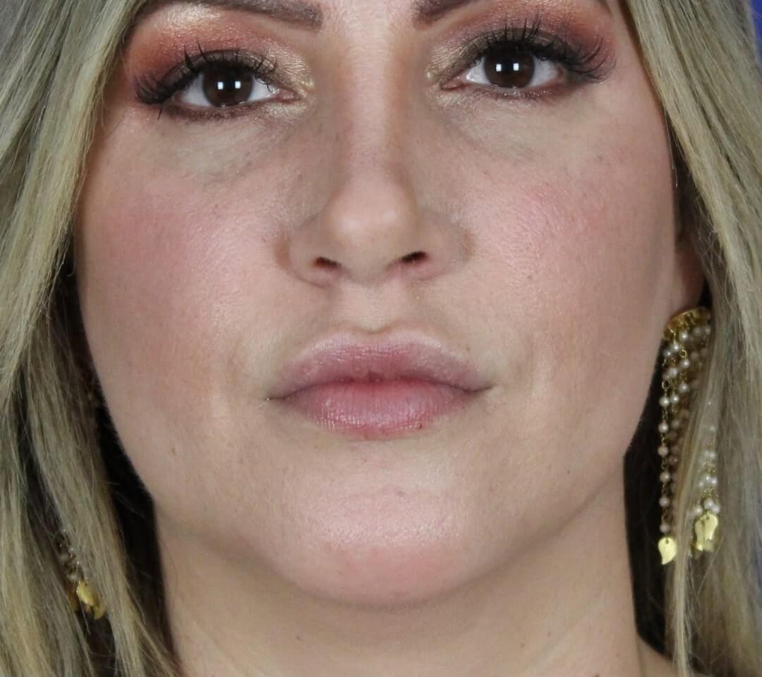 Case--6897 | Before Face 1