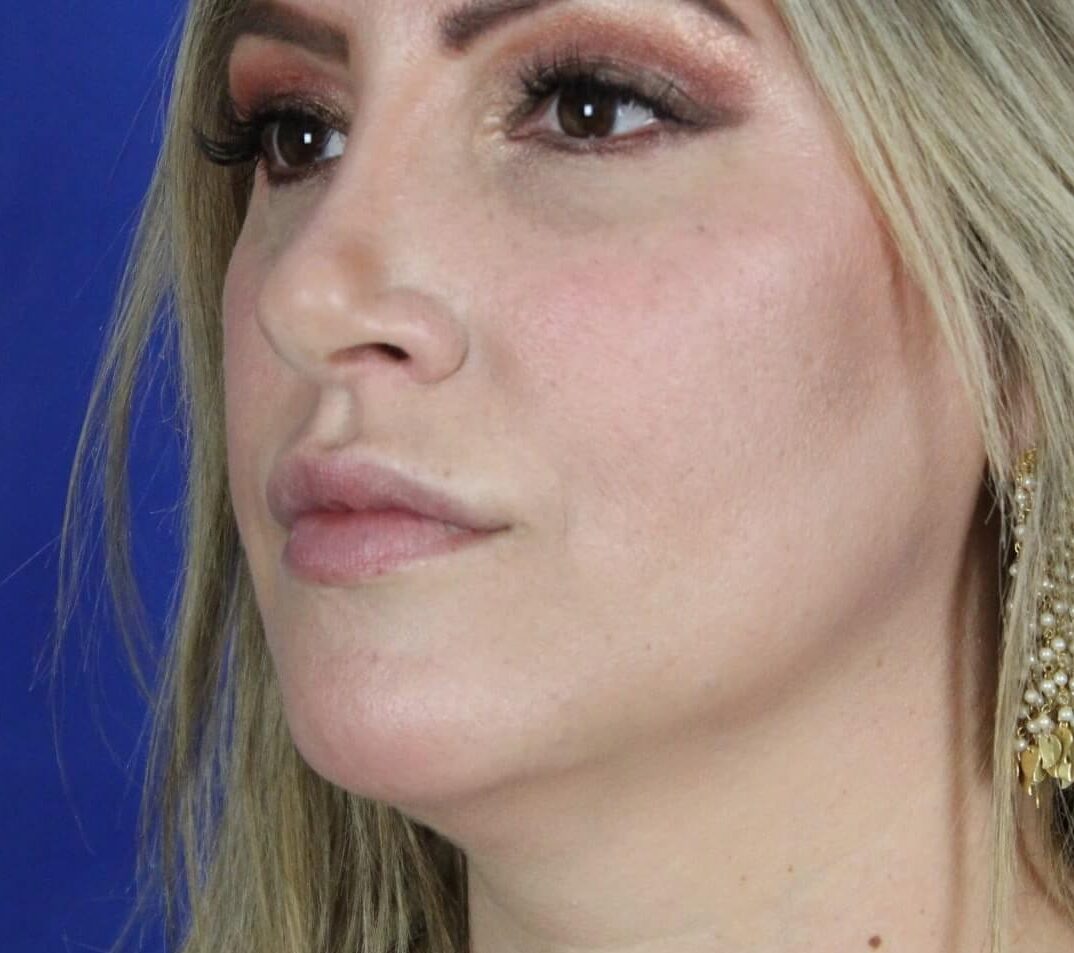 Case--6897 | Before Face 2