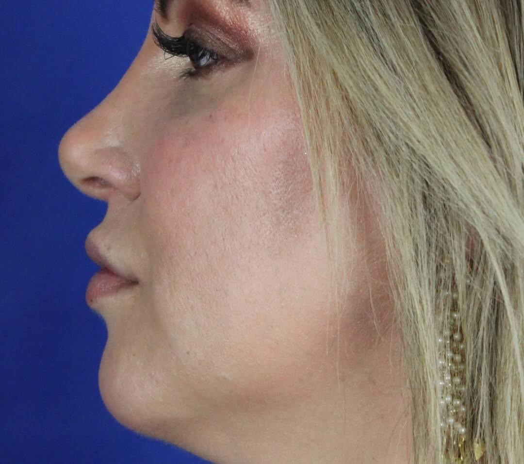 Case--6897 | Before Face 3