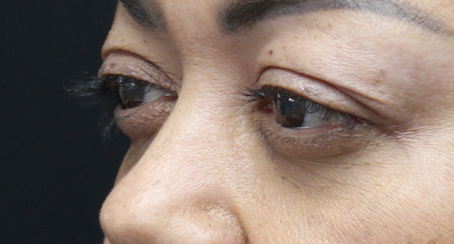 Case--4723 | Before Face 3